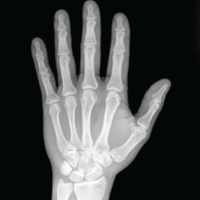X-Ray of a Hand.jpg