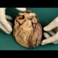Middle Mediastinum and Heart - Anatomy and Dissection Guide