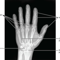 Bones of the Hand.jpg