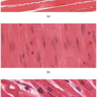 The Three Types of Muscle Tissue 