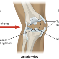 Knee Injury 