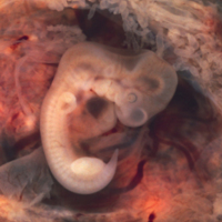 Embryo at Seven Weeks 