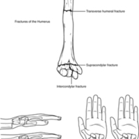 Fractures of the Humerus and Radius 